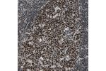 Immunohistochemical staining of human lymph node shows strong nuclear positivity in reaction center cells.