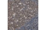 Immunohistochemical staining of human lymph node shows moderate cytoplasmic and nuclear positivity in germinal and non germinal center cells.