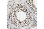 Immunohistochemical staining of human testis shows nuclear positivity in cells in seminiferous ducts.