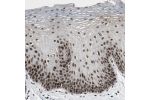 Immunohistochemical staining of human oral mucosa shows strong nuclear positivity in squamous epithelial cells.