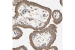 Immunohistochemical staining of human cerebral cortex shows strong cytoplasmic positivity in neuronal cells.
