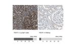 Immunohistochemistry analysis in human lymph node and kidney tissues using Anti-FEN1 antibody. Corresponding FEN1 RNA-seq data are presented for the same tissues.