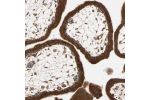 Immunohistochemical staining of human placenta shows strong cytoplasmic positivity in trophoblastic cells.