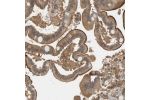Immunohistochemical staining of human duodenum shows strong luminal membranous and cytoplasmic positivity in glandular cells.