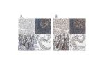 Immunohistochemical staining of human heart muscle, lymph node, rectum and testis using Anti-USP28 antibody HPA006778 (A) shows similar protein distribution across tissues to independent antibody HPA006779 (B).