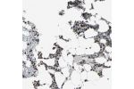 Immunohistochemical staining of human testis shows strong nuclear positivity in cells in seminiferus ducts.
