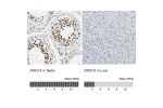 Immunohistochemistry analysis in human testis and liver tissues using HPA006801 antibody. Corresponding XRCC4 RNA-seq data are presented for the same tissues.