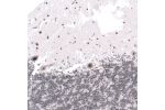 Immunohistochemical staining of human cerebral cortex shows strong cytoplasmic and nuclear positivity in neuronal cells.