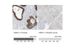 Immunohistochemistry analysis in human prostate and skeletal muscle tissues using HPA006881 antibody. Corresponding NDRG1 RNA-seq data are presented for the same tissues.