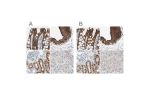 Immunohistochemical staining of human colon, gallbladder, kidney and liver using Anti-VIL1 antibody HPA006884 (A) shows similar protein distribution across tissues to independent antibody HPA006885 (B).