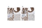 Immunohistochemical staining of human colon, gallbladder, kidney and liver using Anti-VIL1 antibody HPA006885 (A) shows similar protein distribution across tissues to independent antibody HPA006884 (B).