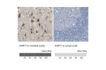 Immunohistochemistry analysis in human cerebral cortex and lymph node tissues using HPA006889 antibody. Corresponding SORT1 RNA-seq data are presented for the same tissues.