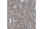Immunohistochemical staining of human parathyroid gland shows moderate membranous positivity in glandular cells.