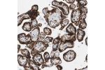Immunohistochemical staining of human stomach shows strong cytoplasmic and membranous positivity in glandular cells.