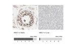 Immunohistochemistry analysis in human testis and liver tissues using Anti-MDC1 antibody. Corresponding MDC1 RNA-seq data are presented for the same tissues.