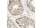 Immunohistochemical staining of human testis shows moderate cytoplasmic positivity in cells in seminiferous ducts.