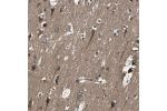 Immunohistochemical staining of human cerebral cortex shows moderate to strong cytoplasmic positivity in neuronal cells.