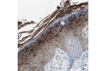 Immunohistochemical staining of human skin shows strong nuclear and cytoplasmic positivity in a subset of epidermal cells.