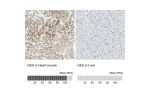 Immunohistochemistry analysis in human heart muscle and liver tissues using HPA007007 antibody. Corresponding NES RNA-seq data are presented for the same tissues.