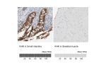 Immunohistochemistry analysis in human small intestine and skeletal muscle tissues using HPA007040 antibody. Corresponding KHK RNA-seq data are presented for the same tissues.