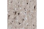 Immunohistochemical staining of human cerebral cortex shows strong granular cytoplasmic positivity in neuronal cells.