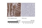 Immunohistochemistry analysis in human skeletal muscle and liver tissues using HPA007042 antibody. Corresponding TTN RNA-seq data are presented for the same tissues.