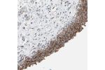 Immunohistochemical staining of human urinary bladder shows strong cytoplasmic positivity in urothelial cells.