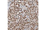 Immunohistochemical staining of human stomach shows strong cytoplasmic positivity in parietal cells.
