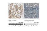 Immunohistochemistry analysis in human kidney and lymph node tissues using HPA007047 antibody. Corresponding CDH6 RNA-seq data are presented for the same tissues.