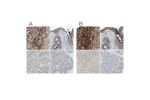 Immunohistochemical staining of human adrenal gland, endometrium, liver and pancreas using Anti-ALPL antibody HPA007105 (A) shows similar protein distribution across tissues to independent antibody HPA008765 (B).