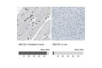 Immunohistochemistry analysis in human skeletal muscle and liver tissues using HPA007114 antibody. Corresponding MEF2D RNA-seq data are presented for the same tissues.