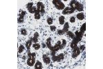 Immunohistochemical staining of human breast shows strong cytoplasmic and membranous positivity in glandular cells.