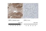 Immunohistochemistry analysis in human smooth muscle and liver tissues using Anti-DMPK antibody. Corresponding DMPK RNA-seq data are presented for the same tissues.
