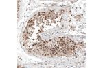 Immunohistochemical staining of human testis shows moderate to strong nuclear positivity in cells in seminiferous ducts.