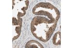 Immunohistochemical staining of human prostate shows strong granular cytoplasmic positivity in glandular cells.
