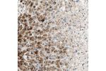 Immunohistochemical staining of human adrenal gland shows strong cytoplasmic positivity in glandular cells.