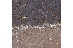 Immunohistochemical staining of human cerebral cortex shows positivity in neuropil.