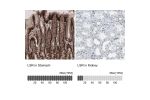 Immunohistochemistry analysis in human stomach and kidney tissues using HPA007270 antibody. Corresponding LSR RNA-seq data are presented for the same tissues.