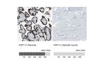 Immunohistochemistry analysis in human placenta and skeletal muscle tissues using HPA007272 antibody. Corresponding KRT7 RNA-seq data are presented for the same tissues.