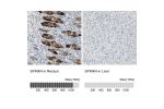 Immunohistochemistry analysis in human rectum and liver tissues using Anti-SPINK4 antibody. Corresponding SPINK4 RNA-seq data are presented for the same tissues.