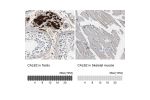 Immunohistochemistry analysis in human testis and skeletal muscle tissues using HPA007305 antibody. Corresponding CALB2 RNA-seq data are presented for the same tissues.