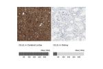 Immunohistochemistry analysis in human cerebral cortex and kidney tissues using HPA007316 antibody. Corresponding GLUL RNA-seq data are presented for the same tissues.