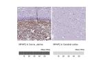 Immunohistochemistry analysis in human cervix, uterine and cerebral cortex tissues using HPA007354 antibody. Corresponding MFAP2 RNA-seq data are presented for the same tissues.