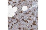 Immunohistochemical staining of human pancreas shows distinct positivity in ductal cells.