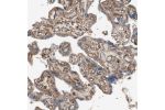 Immunohistochemical staining of human placenta shows moderate membranous positivity in trophoblastic cells.