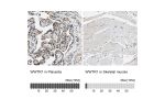 Immunohistochemistry analysis in human placenta and skeletal muscle tissues using HPA007415 antibody. Corresponding WWTR1 RNA-seq data are presented for the same tissues.