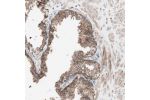 Immunohistochemical staining of human Prostate shows strong cytoplasmic positivity in glandular cells.