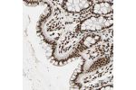 Immunohistochemical staining of human colon shows strong nuclear positivity in glandular cells.