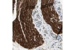Immunohistochemical staining of human smooth muscle shows cytoplasmic positivity in smooth muscle cells.