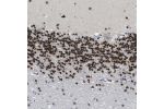 Immunohistochemical staining of human cerebellum shows strong nuclear positivity in cells in granular layer.